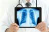 Arzt zeigt Lungen-Röntgenbild auf einem Tablet